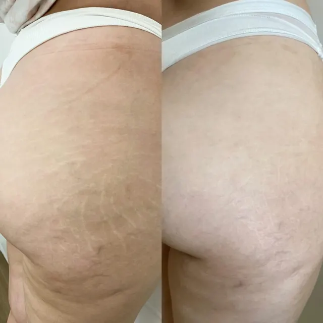 Trabalho de Simone Da Silva