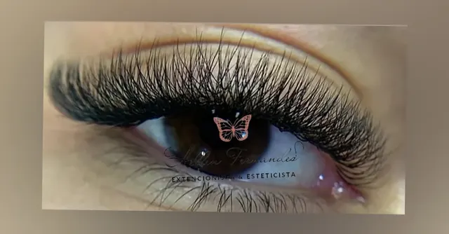 Trabalho de Técnica de estética