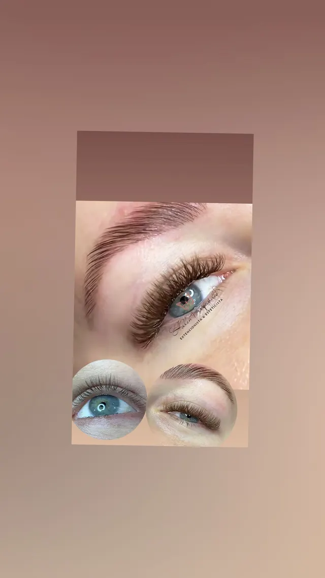 Trabalho de Técnica de estética