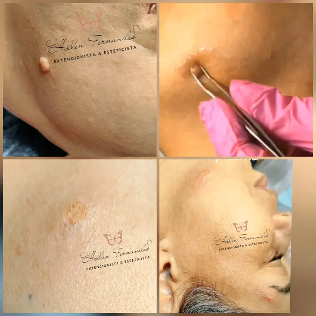 Trabalho de Técnica de estética