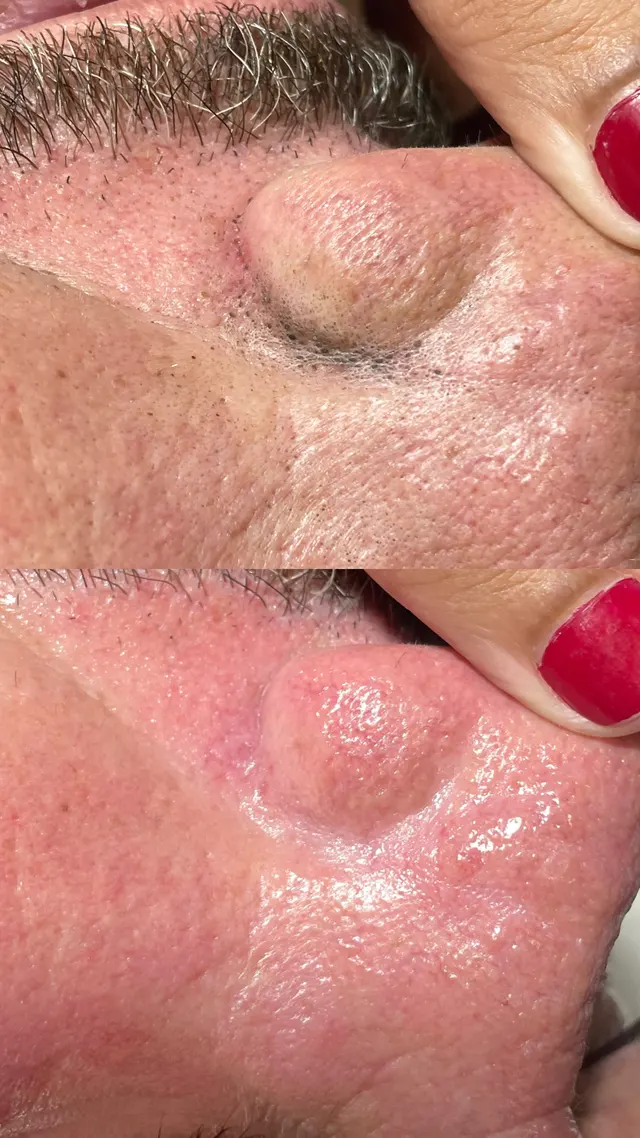 Trabalho de Erica Almeida Estética Facial e Corporal