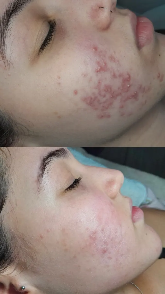 Trabalho de Erica Almeida Estética Facial e Corporal