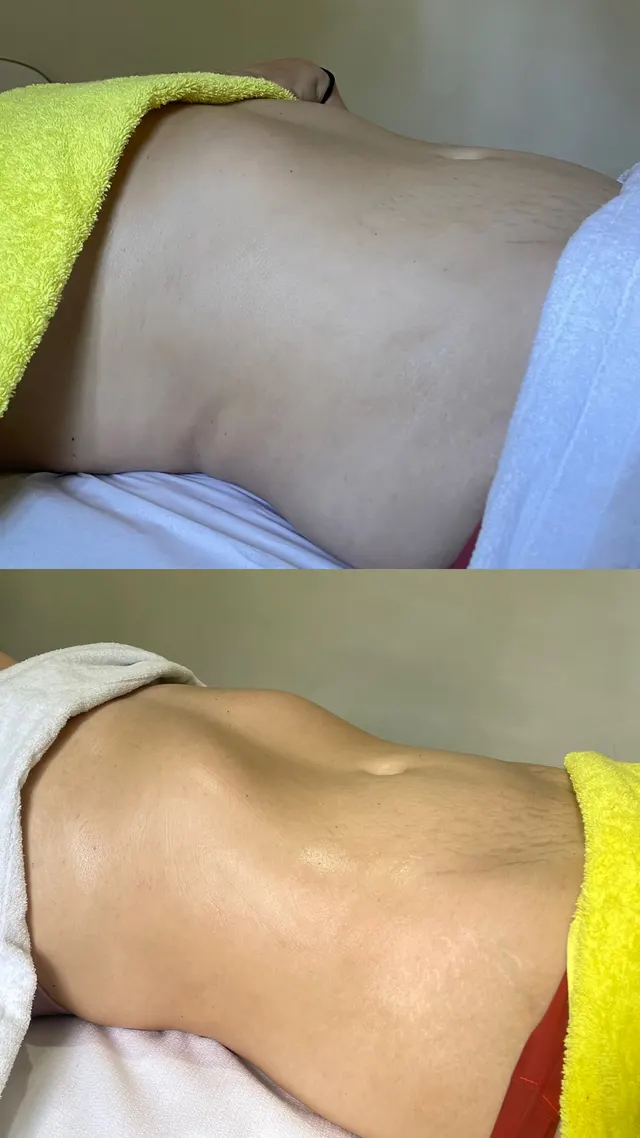 Trabalho de Erica Almeida Estética Facial e Corporal