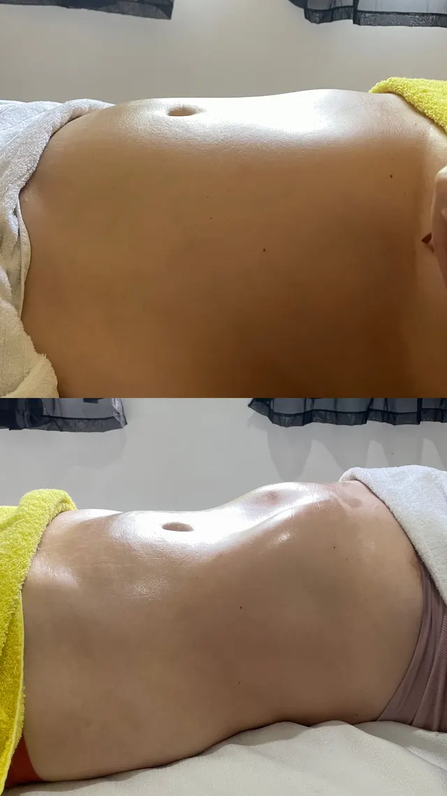 Trabalho de Erica Almeida Estética Facial e Corporal