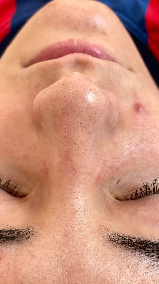 Trabalho de Erica Almeida Estética Facial e Corporal