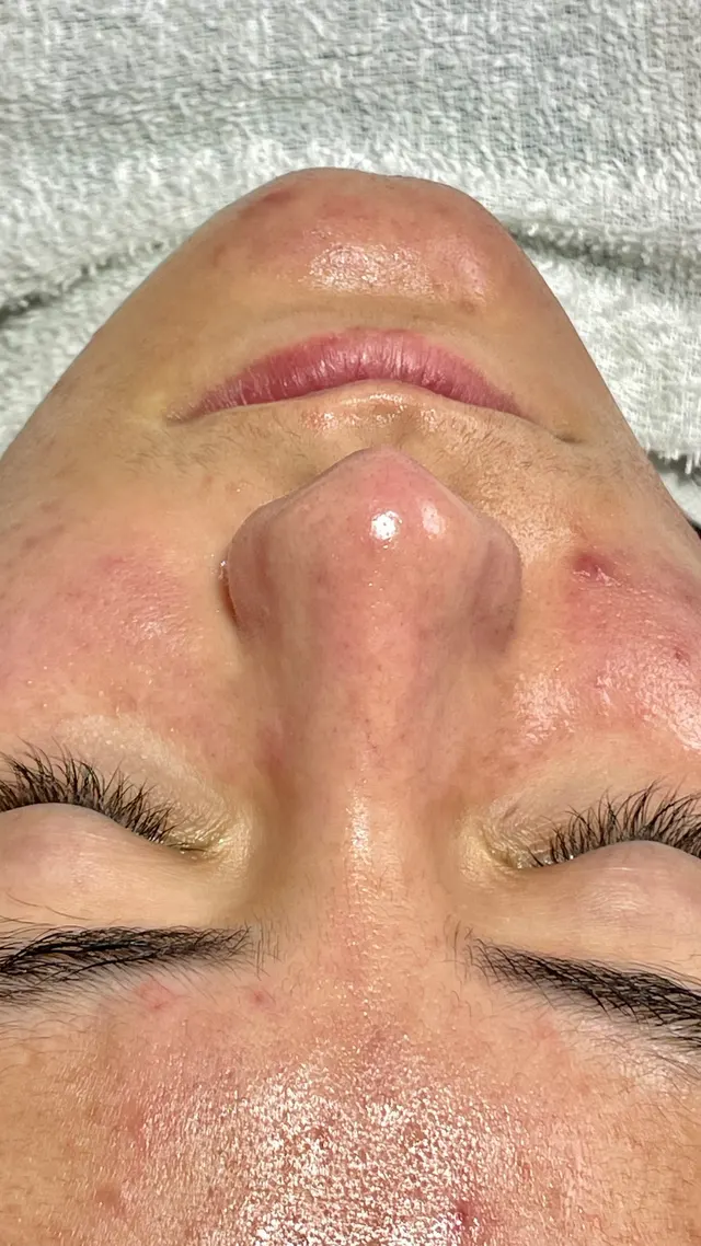 Trabalho de Erica Almeida Estética Facial e Corporal