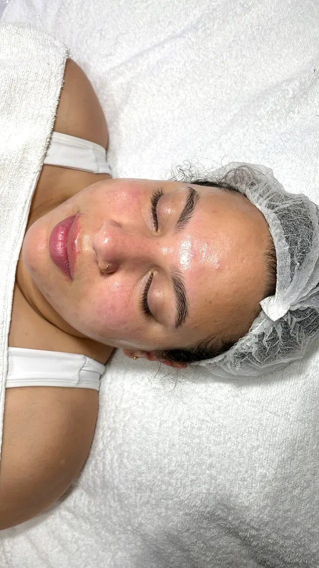 Trabalho de Erica Almeida Estética Facial e Corporal