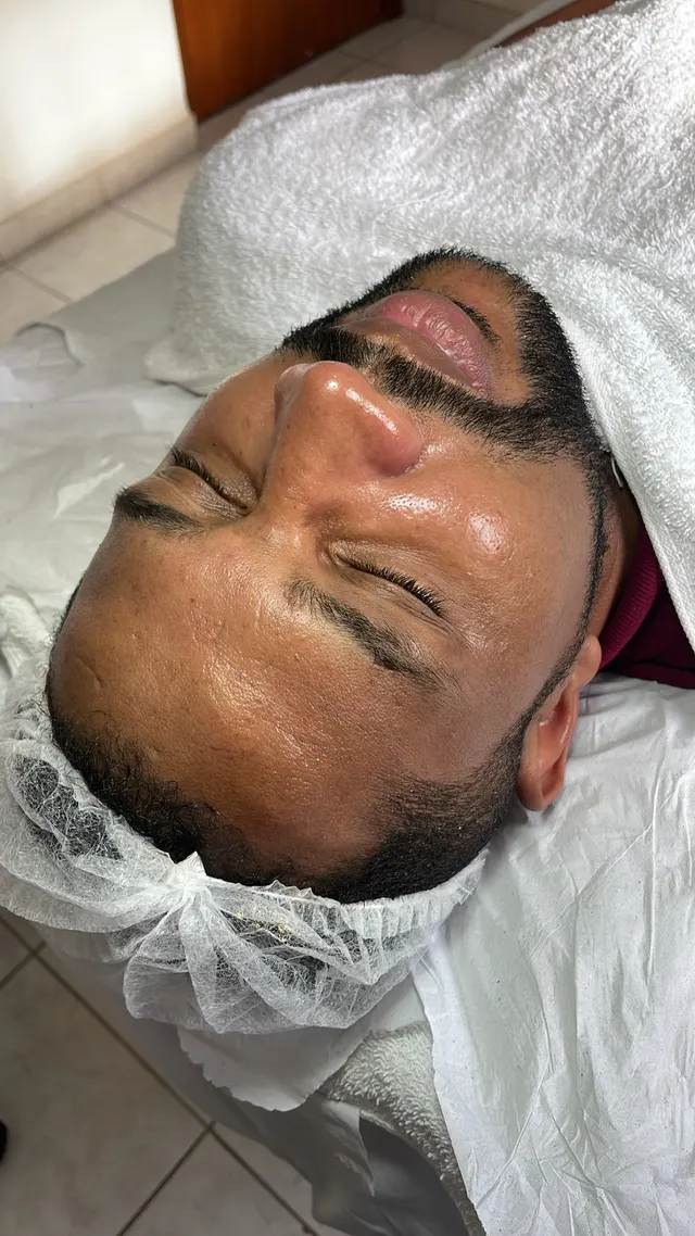 Trabalho de Erica Almeida Estética Facial e Corporal