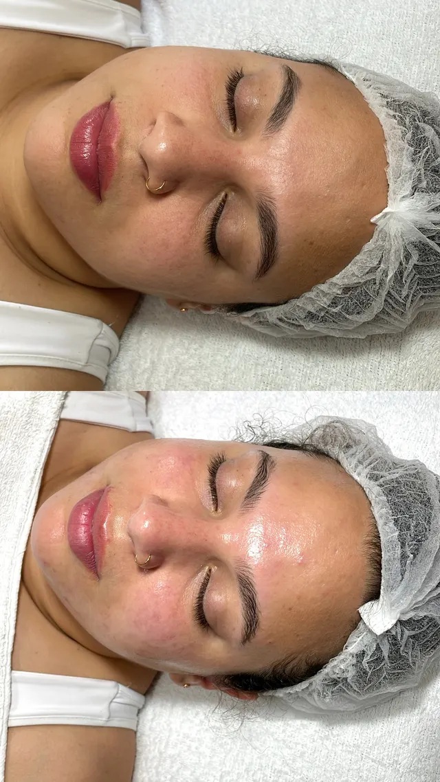 Trabalho de Erica Almeida Estética Facial e Corporal