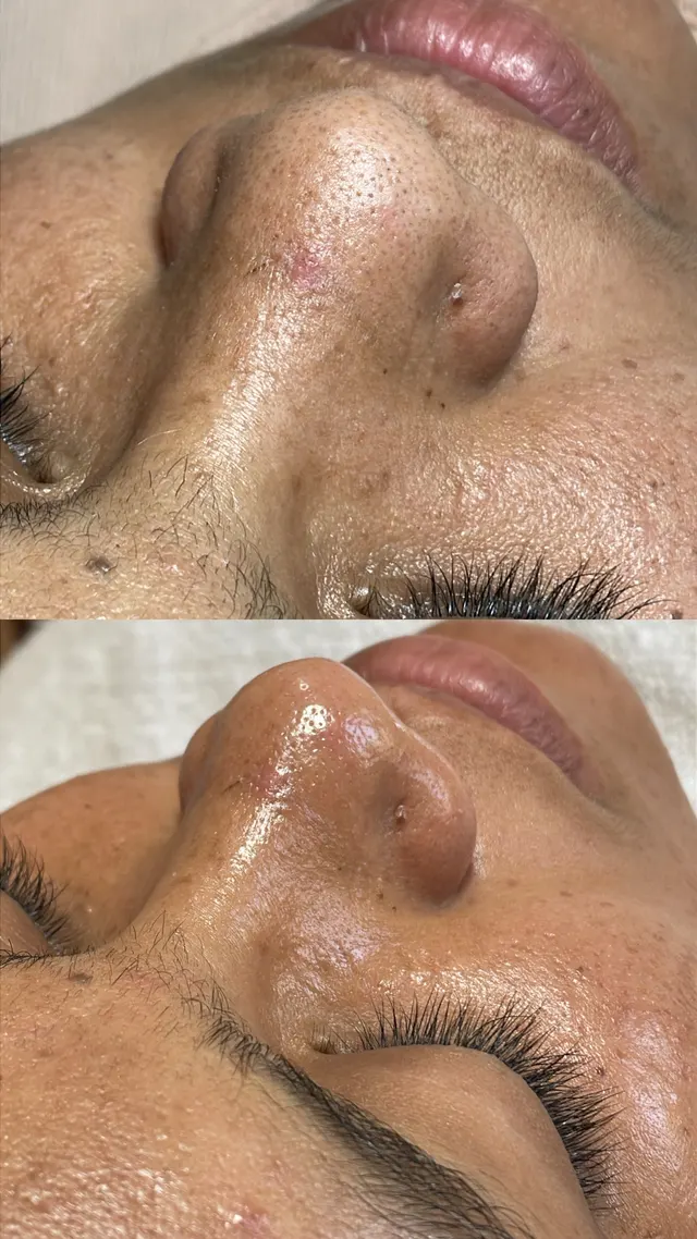 Trabalho de Erica Almeida Estética Facial e Corporal