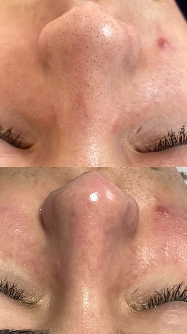 Trabalho de Erica Almeida Estética Facial e Corporal