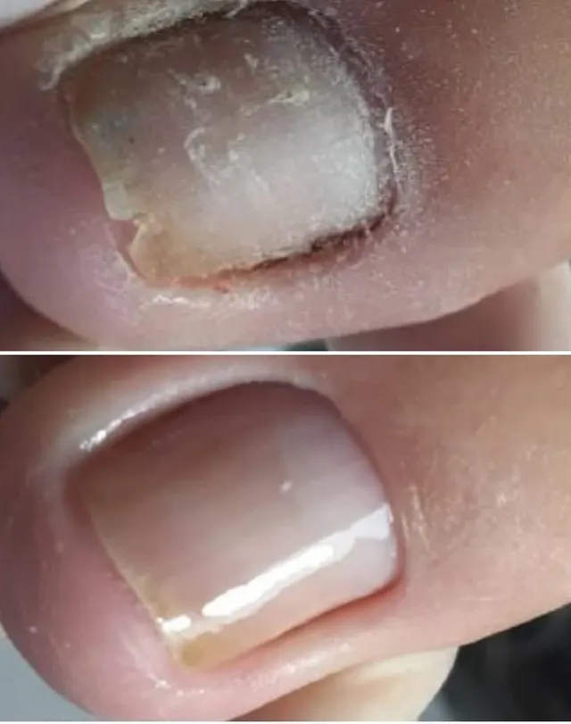 Trabalho de Paula Fernanda podóloga