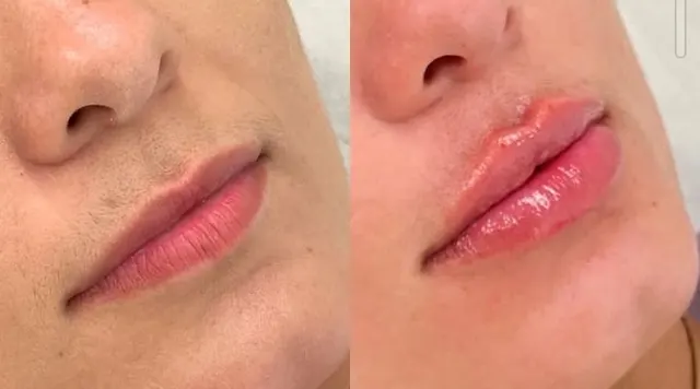 Trabalho de Dra Evelyn marinho
